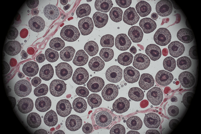 Facing Canine Melanoma With Knowledge Hope and Support - Drake Dog Cancer Foundation